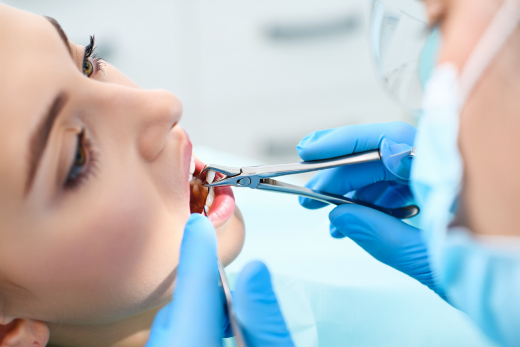 Nhổ Răng Khôn tại Lái Thiêu