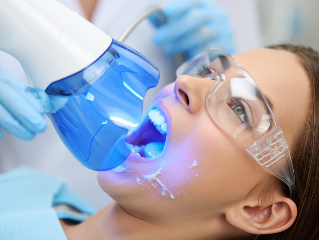 Tẩy Trắng Răng tại Lái Thiêu