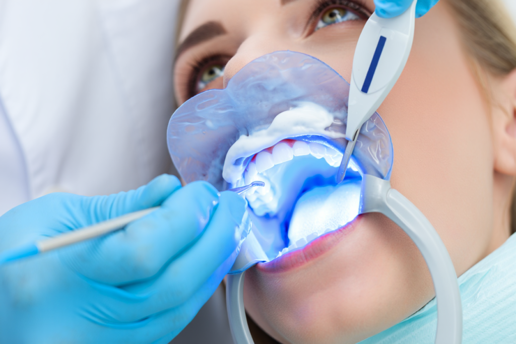 Tẩy Trắng Răng tại Lái Thiêu