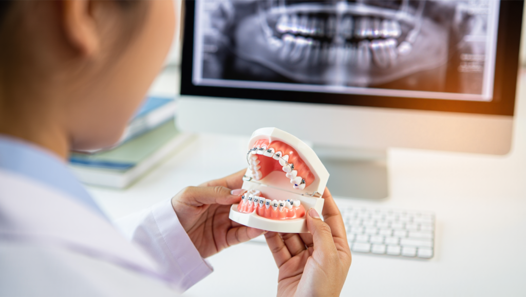 Niềng răng thẩm mỹ tại Lái Thiêu Bình Dương